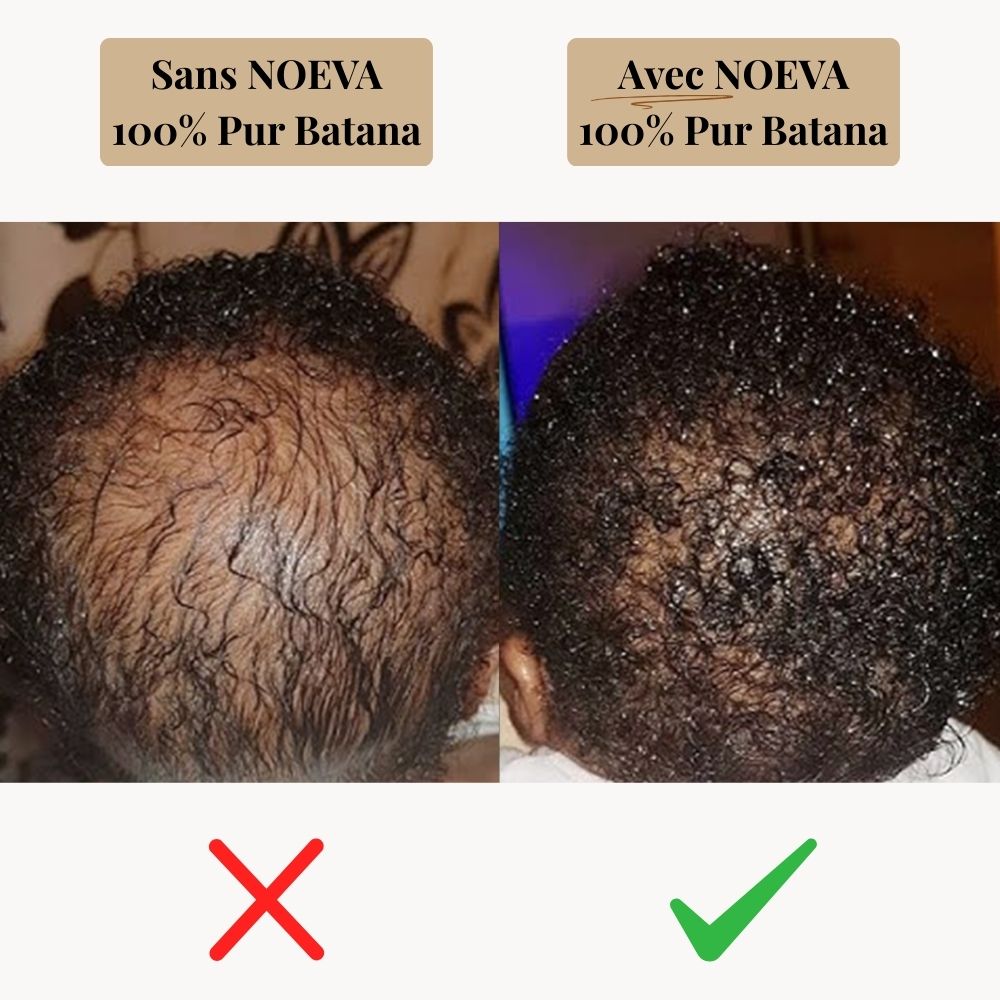 NOEVA - 100% Pur Batana