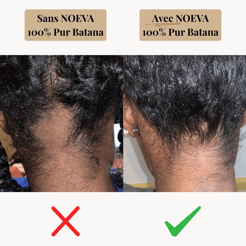 NOEVA - 100% Pur Batana