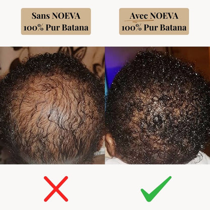 NOEVA - 100% Pur Batana