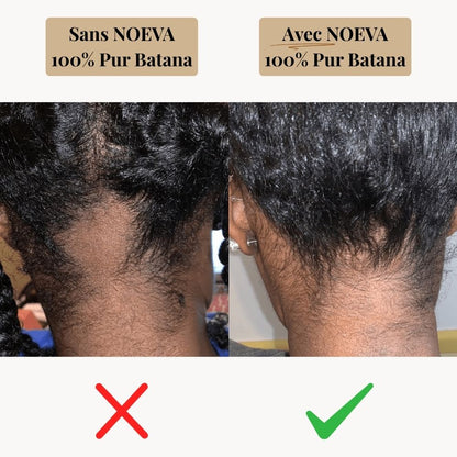 NOEVA - 100% Pur Batana